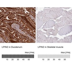 Lipin 2 Antibody, Novus Biologicals:Antibodies:Primary Antibodies